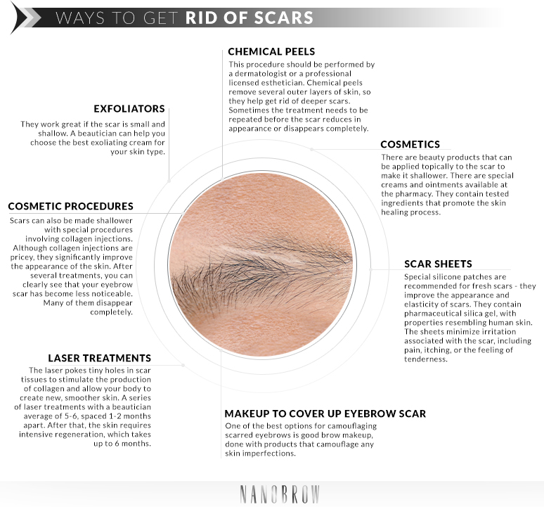 scar in eyebrow how to heal it